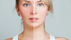 rodoxrous-akmi-madfactory.gr